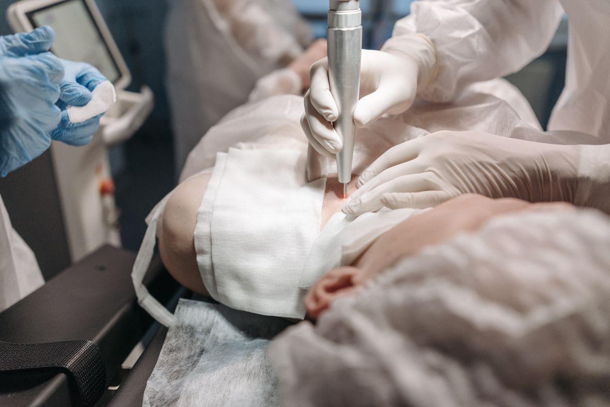 Profesional realizando tratamiento láser facial